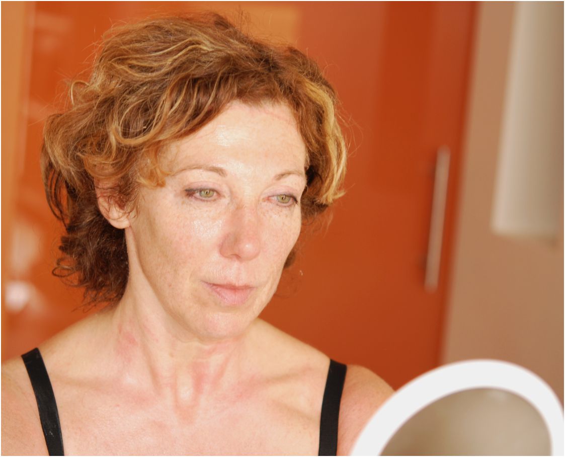 Anja geniet na van haar Environ behandeling