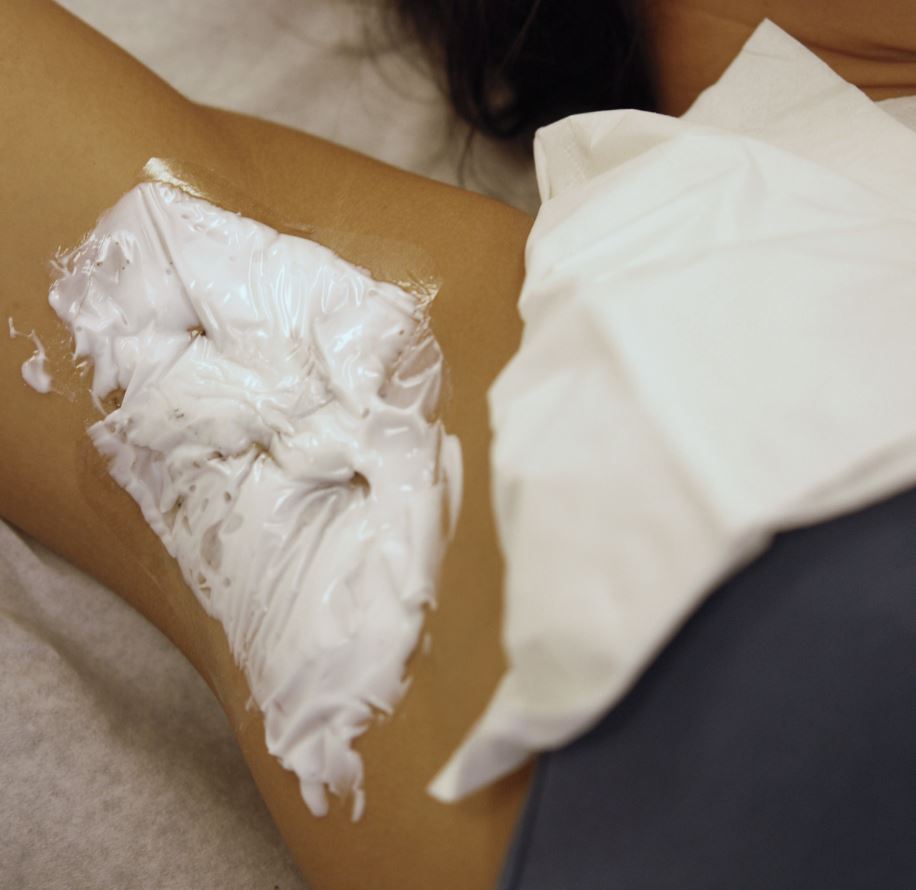 oksel met verdovende creme voor miradry behandeling