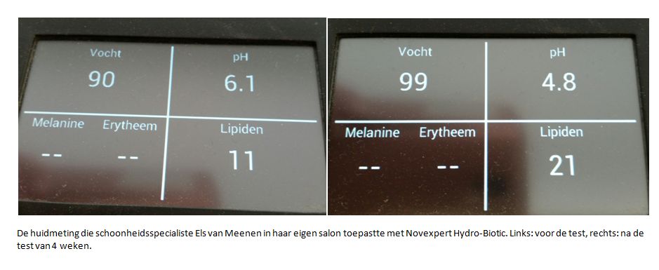 huidmeting voor en na met novexpert hydro biotic gevoelige huid