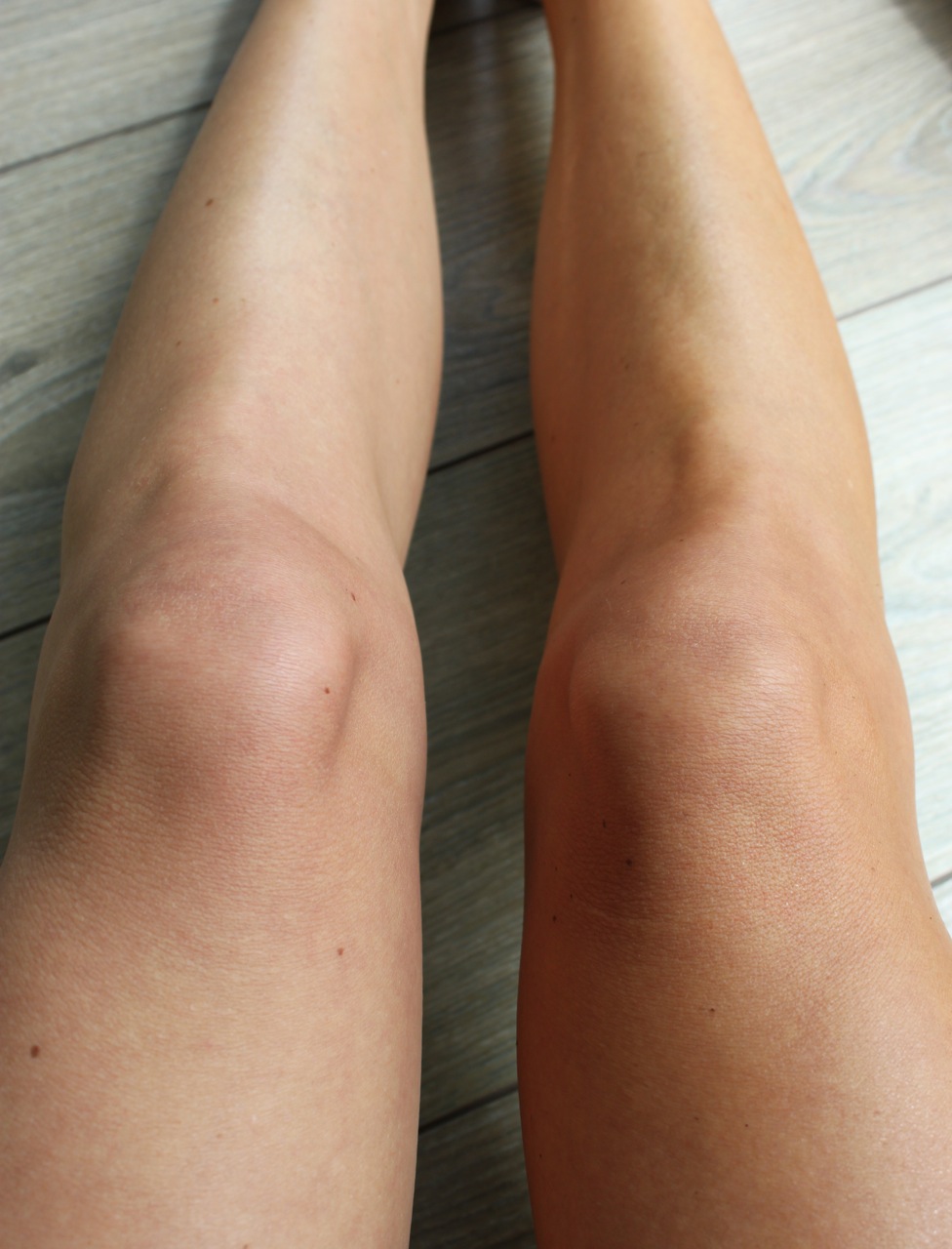 Corine's benen, waarbij het linker been op de foto zonder self tan is, en het rechter met Selftan Lotion.