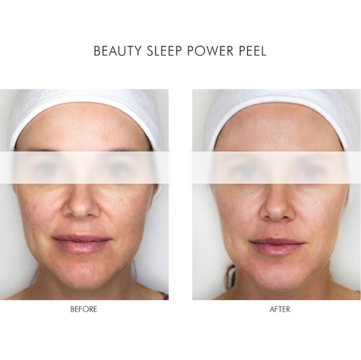 Alpha-H Beauty Sleep Power Peel Before and After