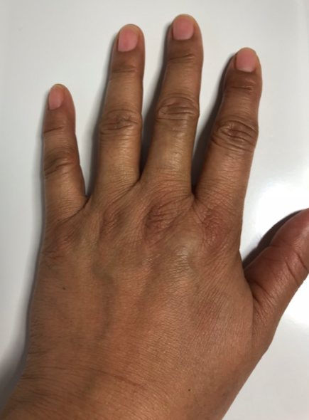 handverzorging