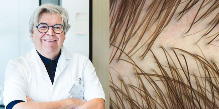 Arts Hans van Montfort over huid en haar in menopauze