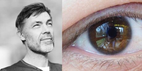 Video! 1 minuut met dr Frank Niessen: wordt het een ooglid lift of wenkbrauw lift?