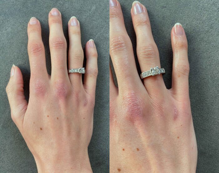 handverzorging