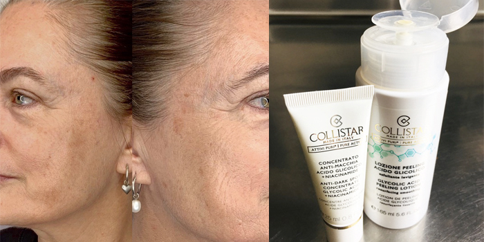 Lydia test Collistar’s Glycolic Acid Peeling Lotion & Dark Spot Concentrate