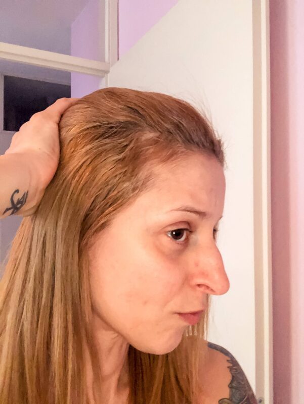 na esthecin