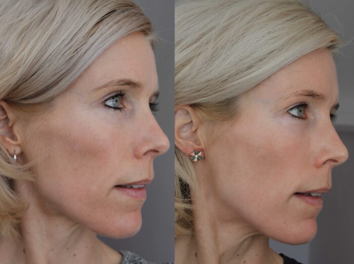 zo skin health