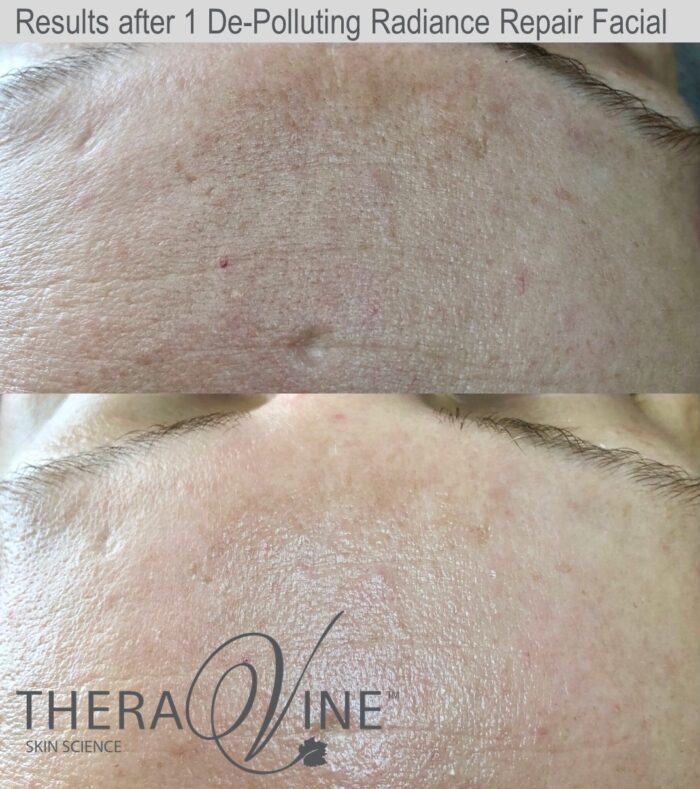 theravine