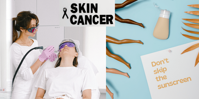 Onderzoek! Kan laser huidschade (-kanker) door UV straling voorkomen?