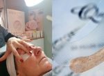 Homepage Dermafiller Patricia