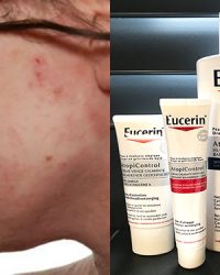 Homepage Eucerin AtopiControl atopisc eczeem