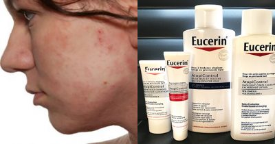 Homepage Eucerin AtopiControl atopisc eczeem
