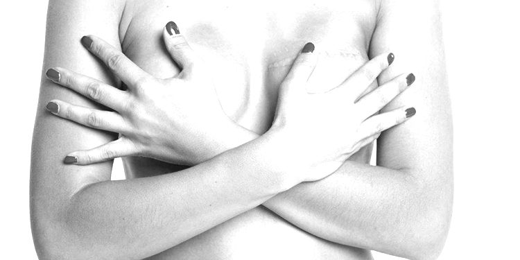 Homepage LPG oncologische nazorg