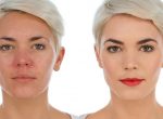 Homepage Lisa Eldridge Rosacea