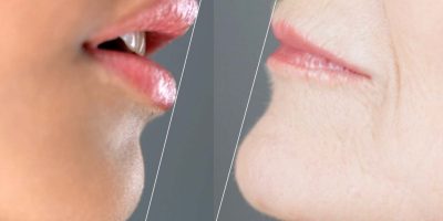 Lippen-verhouding-en-hoek-jong-oud