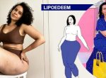 UA-LIPOEDEEM