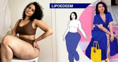 UA-LIPOEDEEM