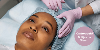 UA bultjes fillers