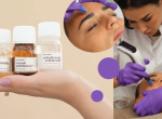 UA microneedling
