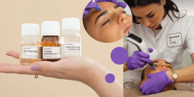 UA microneedling