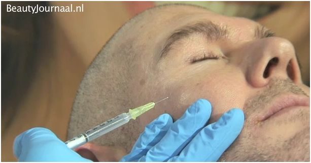 micro botox