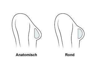 rond en druppelvormig implantaat