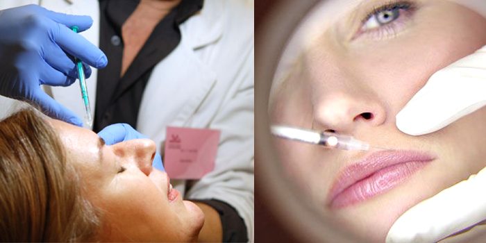 ua-botox
