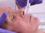 ua dermatude loes