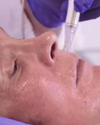 ua dermatude loes