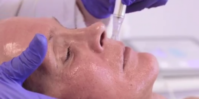 ua dermatude loes