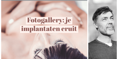 ua implantaten