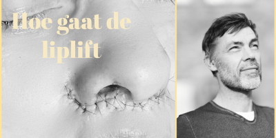 ua liplift