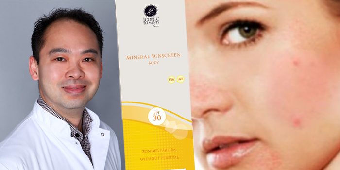 ua-rosacea