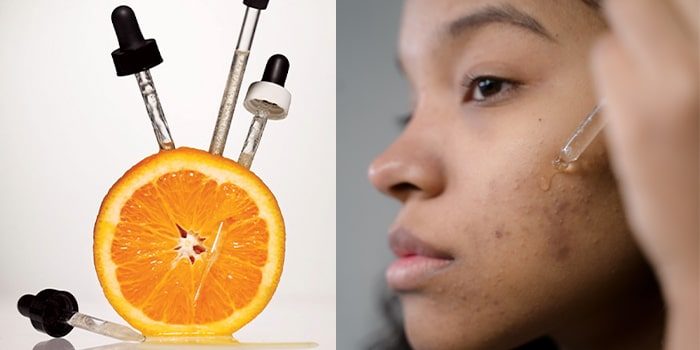 Giet Helemaal droog voorbeeld Vitamine C : welk percentage en welke pH waarde is goed?