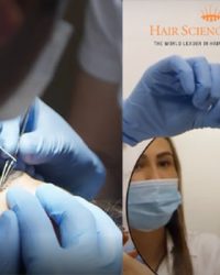 ua-wenkbrauwtransplantatie